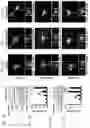 Fig. 02 - Composition and method for treating neuronal ceroid lipofuscinosis