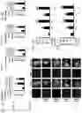 Fig. 03 - Composition and method for treating neuronal ceroid lipofuscinosis