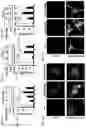 Fig. 04 - Composition and method for treating neuronal ceroid lipofuscinosis