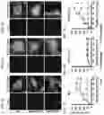 Fig. 06 - Composition and method for treating neuronal ceroid lipofuscinosis