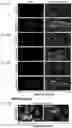 Fig. 09 - Composition and method for treating neuronal ceroid lipofuscinosis