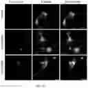 Fig. 16 - Composition and method for treating neuronal ceroid lipofuscinosis