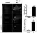 Fig. 06 - Autophagy enhancer and use thereof