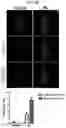 Fig. 07 - Autophagy enhancer and use thereof
