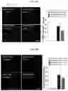 Fig. 35 - Autophagy enhancer and use thereof