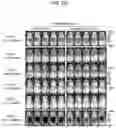Fig. 05 - SCAFFOLDS TO TREAT SOLID TUMOR CELLS AND ESCAPE VARIANTS