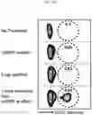 Fig. 16 - SCAFFOLDS TO TREAT SOLID TUMOR CELLS AND ESCAPE VARIANTS