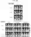 Fig. 33 - SCAFFOLDS TO TREAT SOLID TUMOR CELLS AND ESCAPE VARIANTS