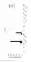 Fig. 07 - Chimeric antigen receptors targeting TIM-1