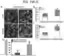 Fig. 12 - ADOPTIVE TRANSFER OF PLASMACYTOID DENDRITIC CELLS TO PREVENT OR TREAT OCULAR DISEASES AND CONDITIONS