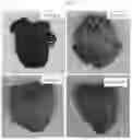 Fig. 02 - Composition for preventing or treating hyperlipidemia