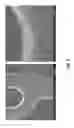 Fig. 03 - COATED STENT WITH SURFACE STRUCTURE OR PLACEHOLDER MATERIAL TO REDUCE CRACK FORMATION