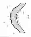 Fig. 04 - COATED STENT WITH SURFACE STRUCTURE OR PLACEHOLDER MATERIAL TO REDUCE CRACK FORMATION
