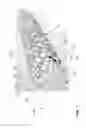 Fig. 08 - COATED STENT WITH SURFACE STRUCTURE OR PLACEHOLDER MATERIAL TO REDUCE CRACK FORMATION