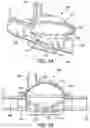 Fig. 02 - Automatic detection and adjustment of a pressure pod diaphragm