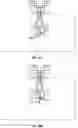 Fig. 28 - Devices and methods for providing a bolus dose in a microfluidic circuit of a pump