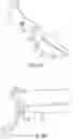 Fig. 06 - Safe cannulation devices, methods, and systems