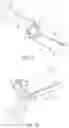 Fig. 07 - Safe cannulation devices, methods, and systems
