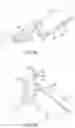 Fig. 09 - Safe cannulation devices, methods, and systems