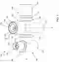 Fig. 02 - Respiratory valve apparatus and related method