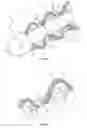 Fig. 09 - Procedural sheath