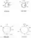 Fig. 08 - Systems and methods for treating a vessel using focused force