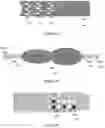 Fig. 08 - Treatment for hydrocephalus
