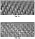 Fig. 02 - Microarray for delivery of therapeutic agent and methods of use