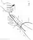 Fig. 02 - Systems and connectors for hemostasis valves and related methods