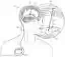 Fig. 01 - SYSTEMS AND METHOD FOR DEEP BRAIN STIMULATION