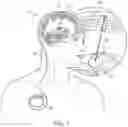 Fig. 02 - SYSTEMS AND METHOD FOR DEEP BRAIN STIMULATION