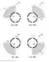 Fig. 31 - Unwrapped 2D view of a stimulation lead with complex electrode array geometry