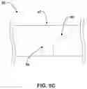 Fig. 09 - Fixation device for medical device retention