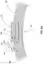 Fig. 10 - Fixation device for medical device retention