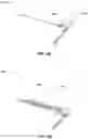 Fig. 15 - Fixation device for medical device retention