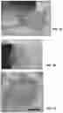 Fig. 08 - Prevention of reflux induced laryngospasm