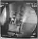 Fig. 01 - Motor devices for motor nerve root stimulation