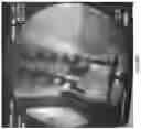 Fig. 08 - Motor devices for motor nerve root stimulation