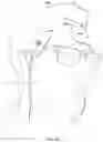 Fig. 07 - Apparatuses and methods for transdermal electrical stimulation of nerves to modify or induce a cognitive state