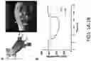 Fig. 02 - Systems and methods for percutaneous nerve stimulation
