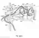 Fig. 28 - METHODS FOR STIMULATING A DORSAL ROOT GANGLION