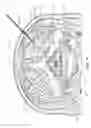 Fig. 45 - METHODS FOR STIMULATING A DORSAL ROOT GANGLION