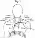 Fig. 02 - Systems and related methods for optimization of multi-electrode nerve pacing