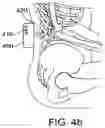 Fig. 06 - SYSTEMS AND METHODS FOR IMPLANTABLE LEADLESS TISSUE STIMULATION