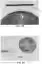 Fig. 07 - Controlled stimulation delivery from neurostimulator