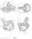 Fig. 02 - Ultralight front jaw