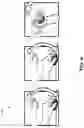 Fig. 09 - PLATFORM FOR GESTURAL GAMING DEVICE