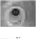 Fig. 04 - Method for feeding a fluid to a gas phase polymerization reactor