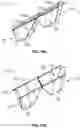 Fig. 12 - Apparatuses, methods, and systems for vibratory screening