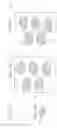 Fig. 05 - Dissolvable compositions and tools including particles having a reactive shell and a non-reactive core
